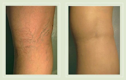 🔥2026 1-Second Airbrushed Leg Concealer🦵