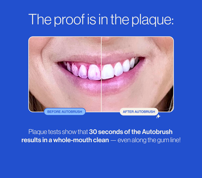 🦷U-shaped electric soft-bristled toothbrush✨