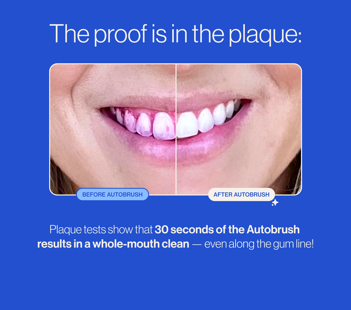 U-shaped electric soft-bristled toothbrush