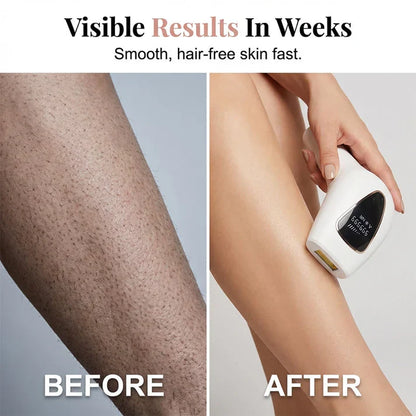 🔥LAST DAY 70%OFF🔥 Painless Hair Removal Device for Women
